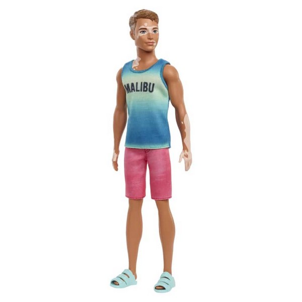Barbie Fashionista Fiú Baba - Vitiligós #192